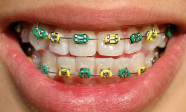 teeth4