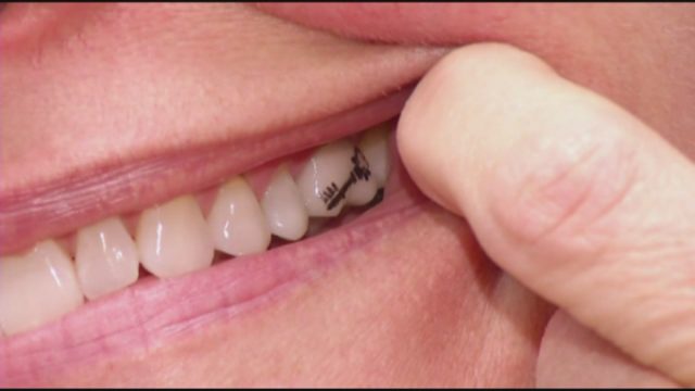 tooth tattoo