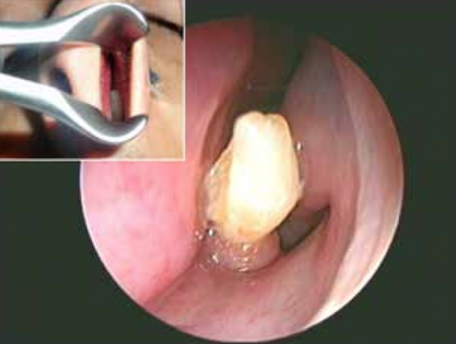 tooth9