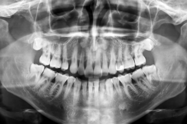 Dental Scan
