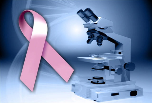 Breast-Cancer-Research