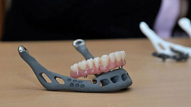 3d-printed-jawbone