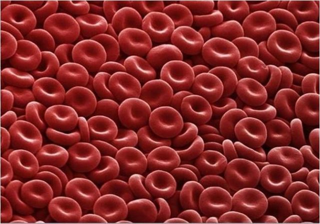 hemophilia-misunderstand