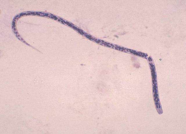 eyeparasites1