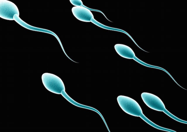 sperm